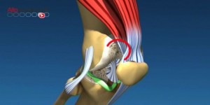 arthrose podologue crimée